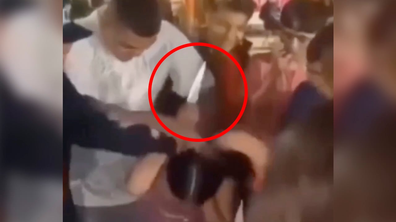 Joven acuchilla en el ojo a su amigo por accidente tras clásica ‘mordida’ al pastel