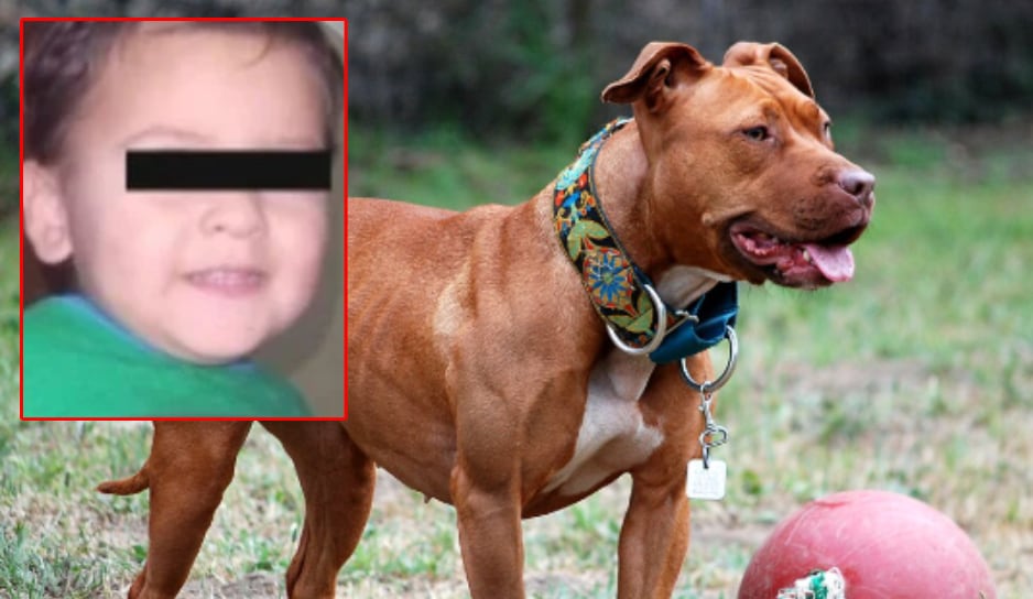 Madre relata como fue que un pitbull atacó a su hijo de 3 años