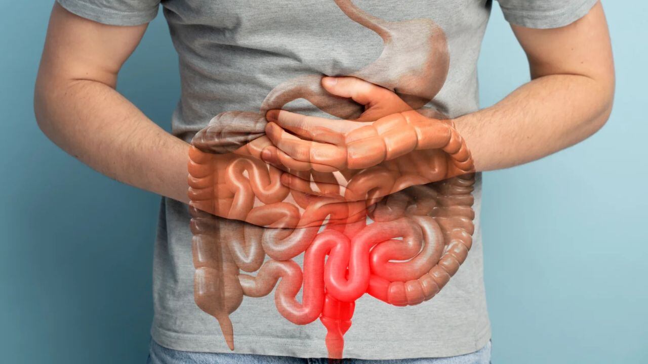 ¿Cómo saber si tengo una Enfermedad Inflamatoria Intestinal?