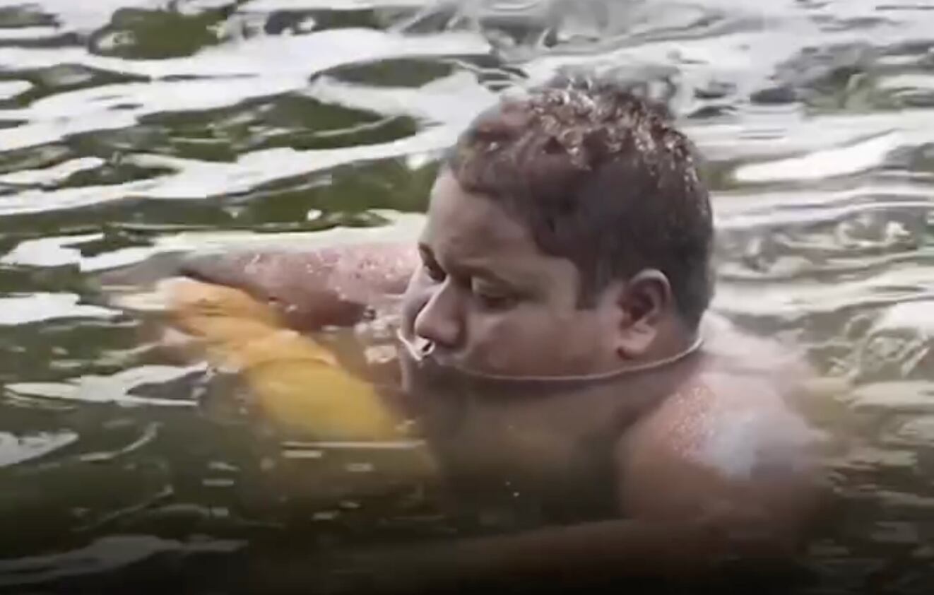 Joven pasa cinco años sin salir del agua por ardor en la piel | VIDEO 
