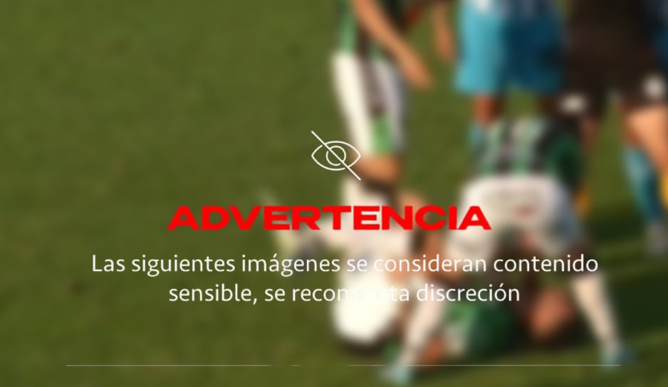 VIDEO: Momento en que futbolista queda con el tobillo COLGANDO tras fuerte barrida