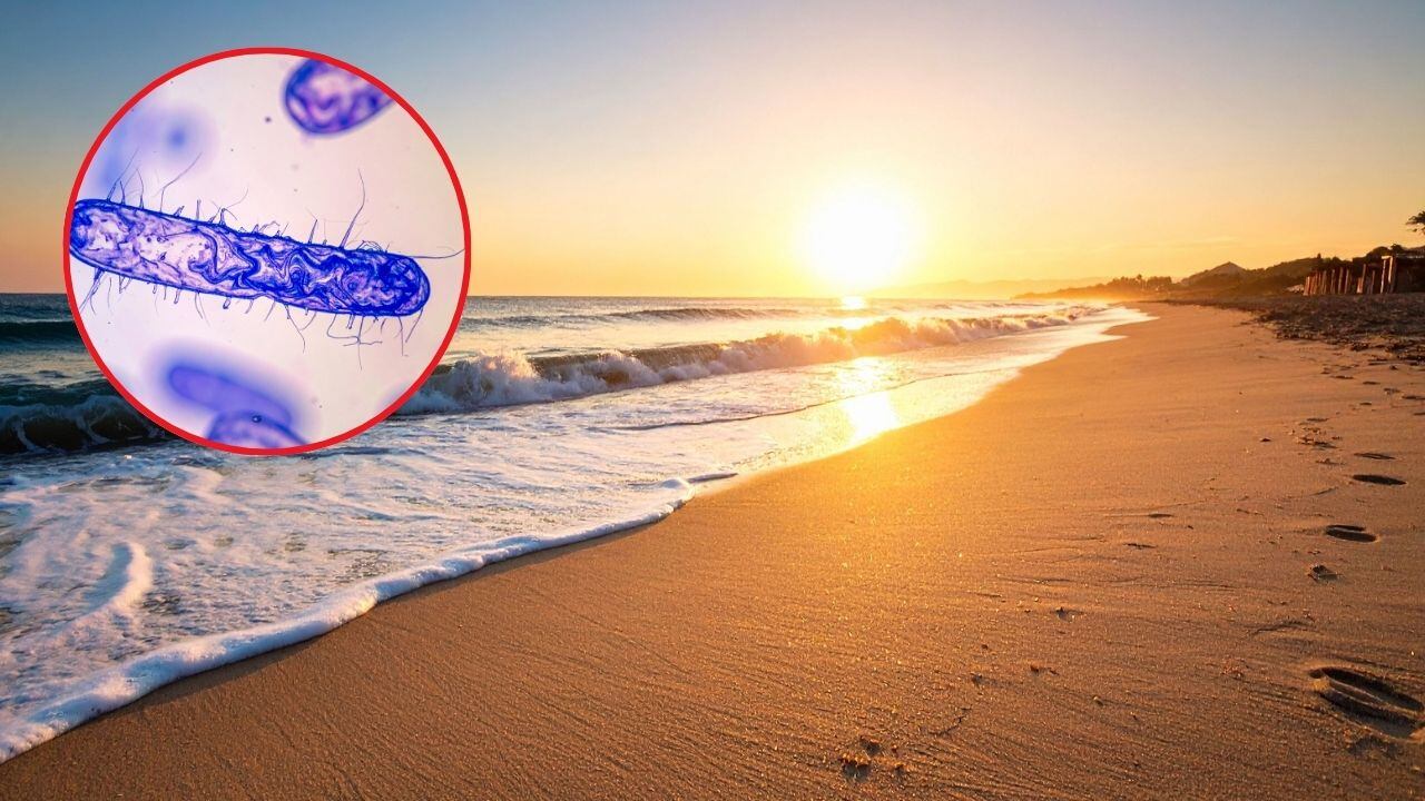 Bacteria devoradora de carne cómo se contagia, síntomas y quiénes están en riesgo.jpg