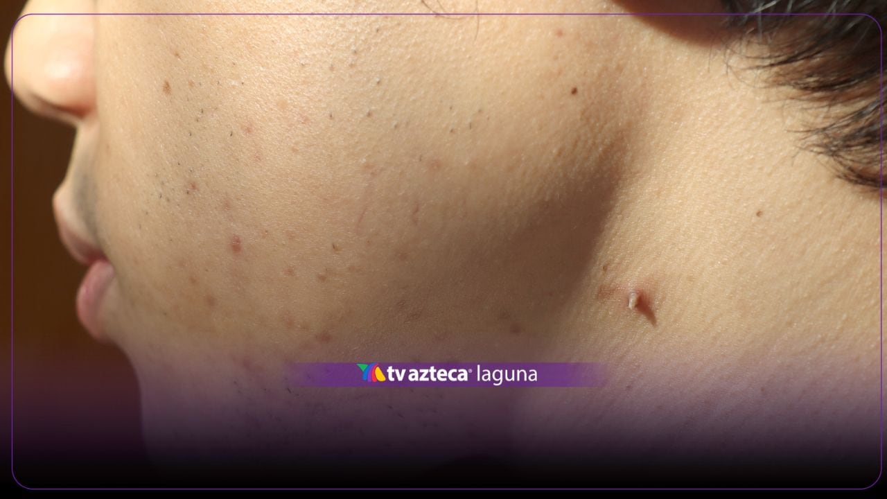 ¡Ten cuidado! Alertan por riesgo de contagios de VPH en peluquerías de México