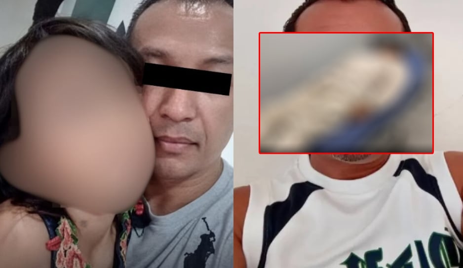 Filtran IMÁGEN de como quedo Sirenio ‘N’ quien EMBARAZÓ a la niña de 11 años tras ser atacado brutalmente